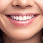 Symmetrical Smile